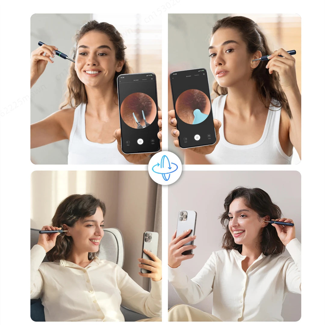 Note5 HD Visual Ear Cleaner with Tweezers – Smart Otoscope Tool