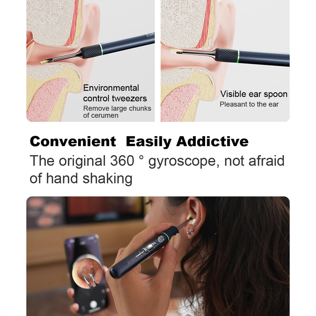 Note5 HD Visual Ear Cleaner with Tweezers – Smart Otoscope Tool