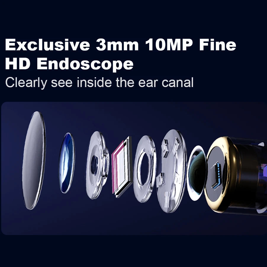 Note5 HD Visual Ear Cleaner with Tweezers – Smart Otoscope Tool